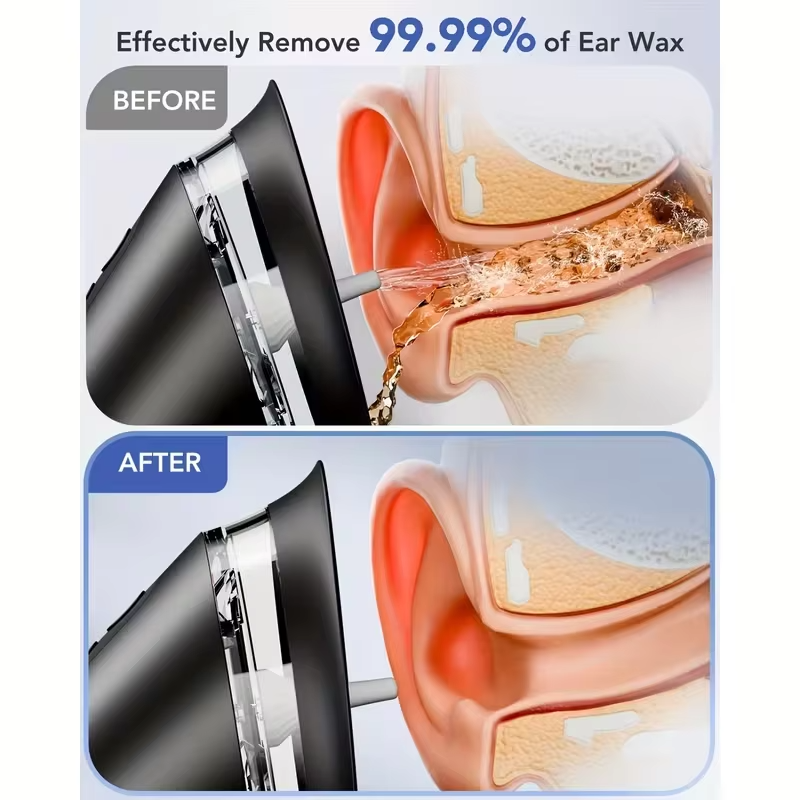 ClerWax™ Electric Ear Wax Removal Kit